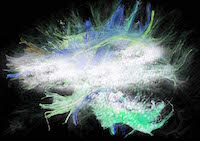 Markéta Preňková: NEUROPLASTICITY